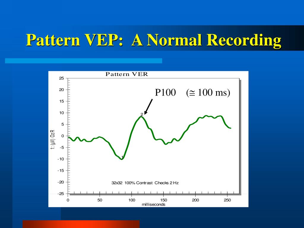 PPT Functional Testing of the Eye Clinical Electrophysiology of