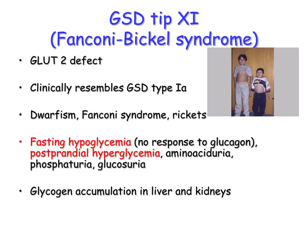Use Of Glucagon And Ketogenic Hypoglycemia : Interviewing Doctors, Researchers, Scientists ...