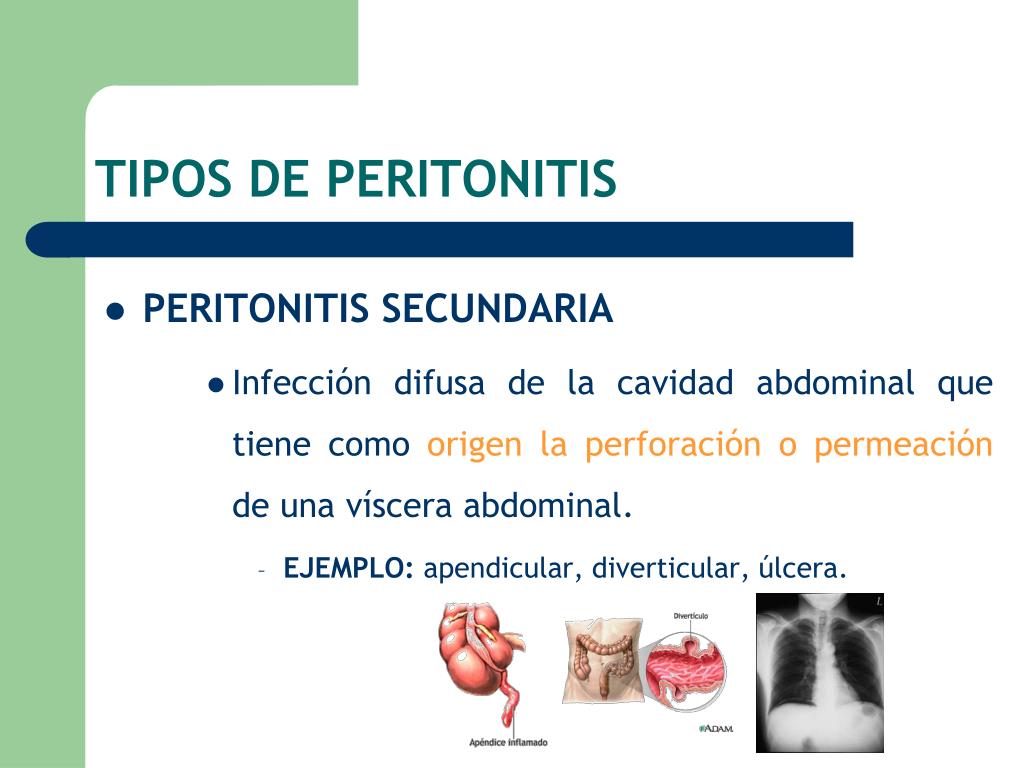 PPT - Tratamiento Empírico de la Infección Intrabdominal PowerPoint