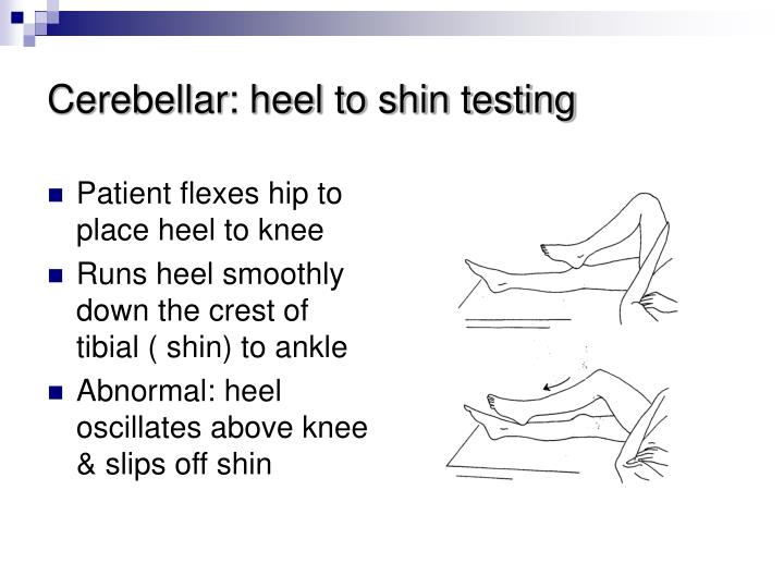 PPT Neurological Examination PowerPoint Presentation ID3736047 PPT Neurological Examination PowerPoint Presentation ID3736047