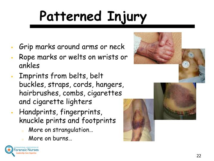 PPT Assessing Patients for Signs of Elder Mistreatment PowerPoint