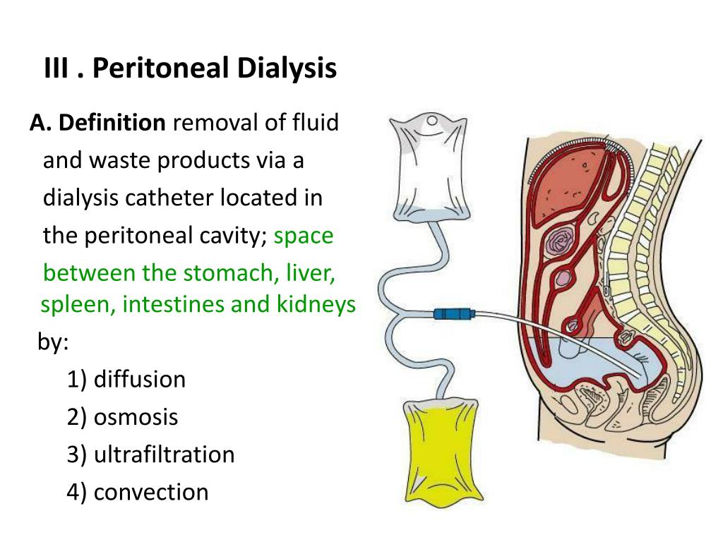 what-is-peritoneal-dialysis-with-pictures