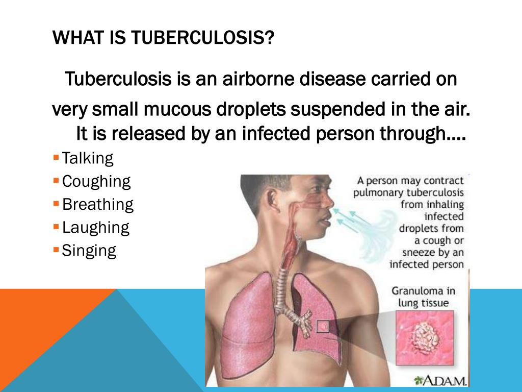 Туберкулез на латинском. Туберкулез на английском. Симптомы туберкулеза на английском языке. Prevention of tuberculosis.