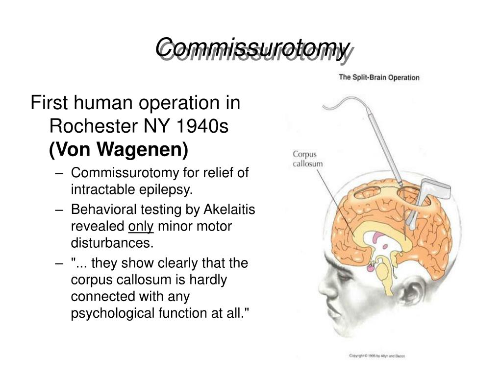 PPT Forebrain Commissures PowerPoint Presentation Free Download ID 