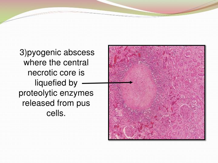 PPT - Cell injury PowerPoint Presentation - ID:3767783