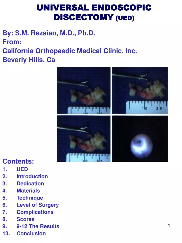 PPT UNIVERSAL ENDOSCOPIC DISCECTOMY (UED) PowerPoint Presentation