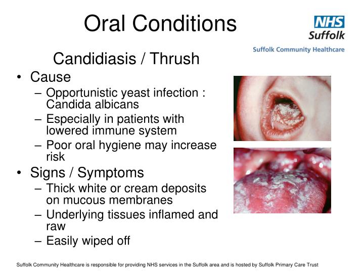 PPT Oral Care for Paediatric Hospice Patients PowerPoint Presentation
