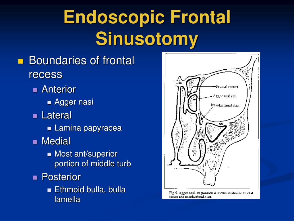 PPT - Concepts of Endoscopic Sinus Surgery: Causes of Failure