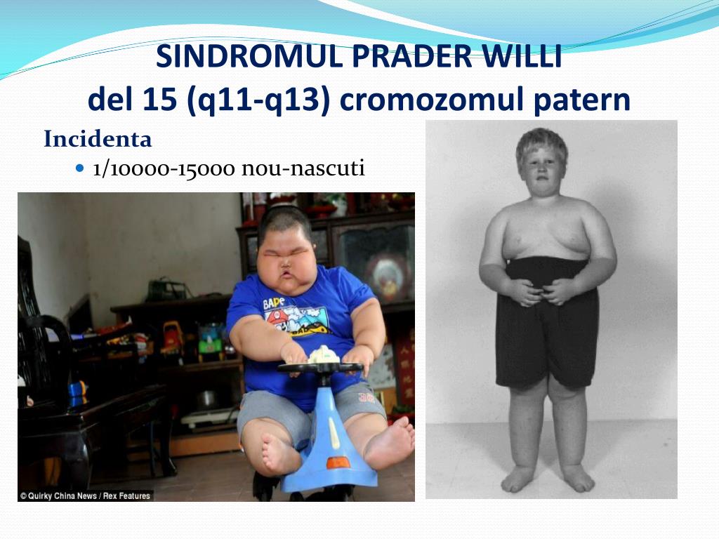 PPT - BOLI CROMOZOMIALE PowerPoint Presentation, free download - ID:3789082
