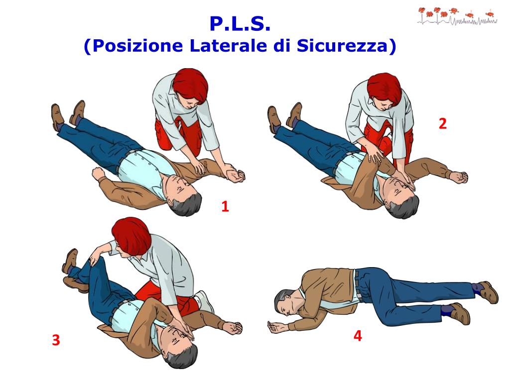 Боковое положение. Уложить пострадавшего на бок. Безопасное боковое положение пострадавшего. Перевернуть пострадавшего на бок. Боковое стабильное положение пострадавшего.
