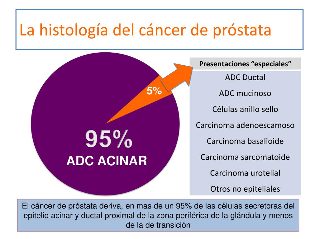 adc de prostata