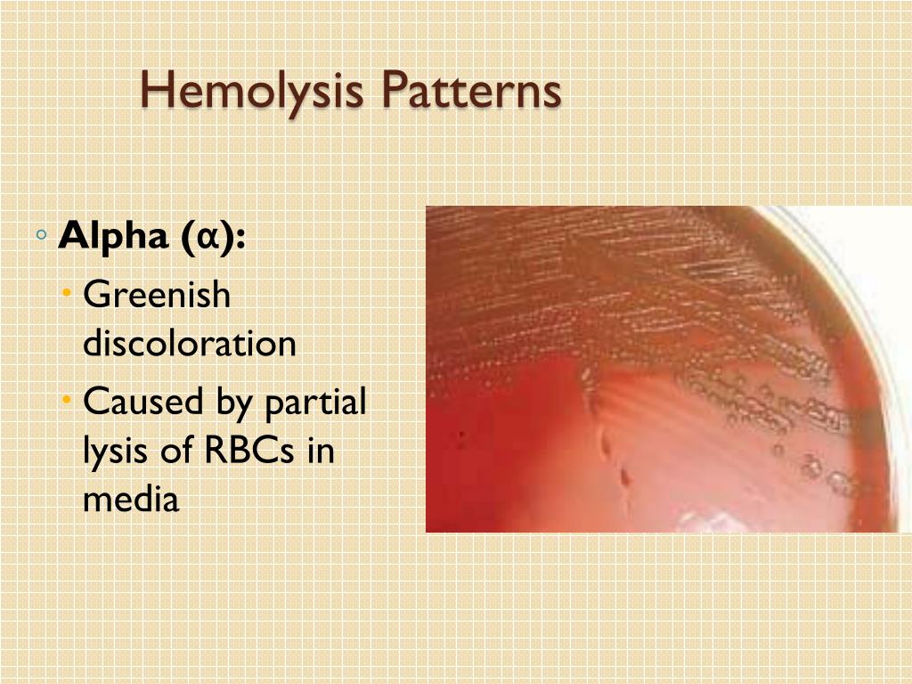 PPT MLAB 2434 Microbiology Keri BrophyMartinez PowerPoint