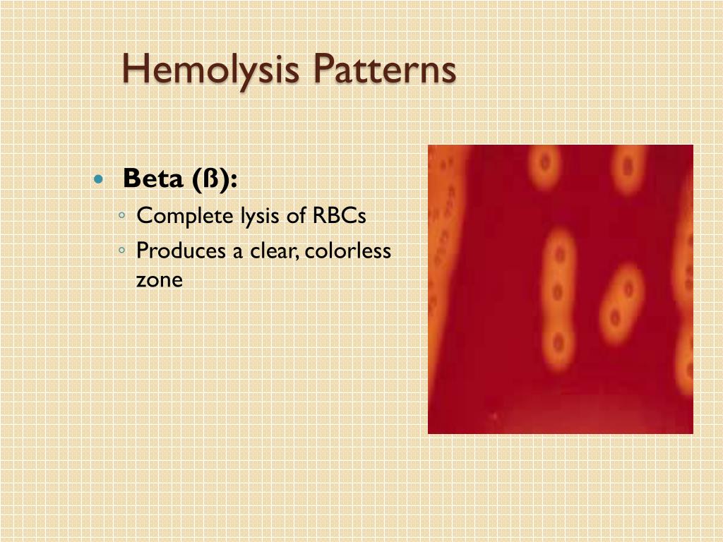 PPT MLAB 2434 Microbiology Keri BrophyMartinez PowerPoint