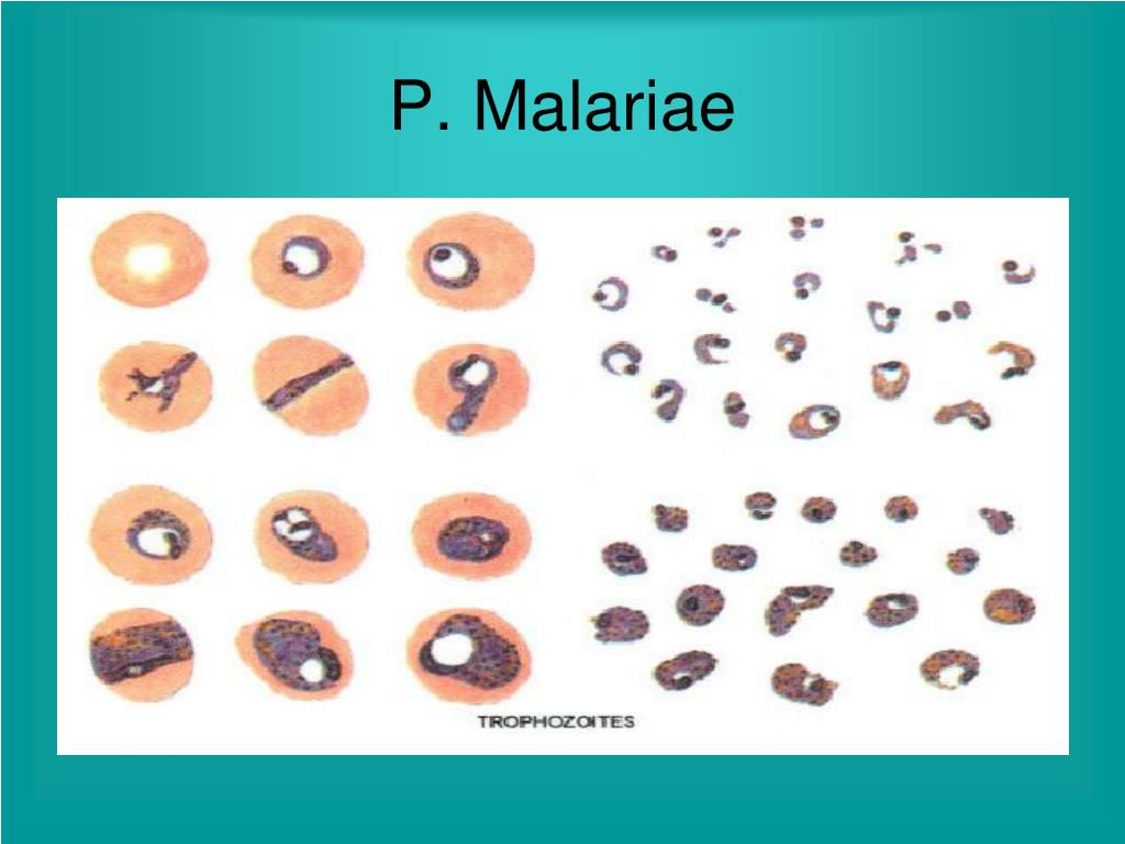 PPT - PEMERIKSAAN MIKROSKOPIS MALARIA PowerPoint 