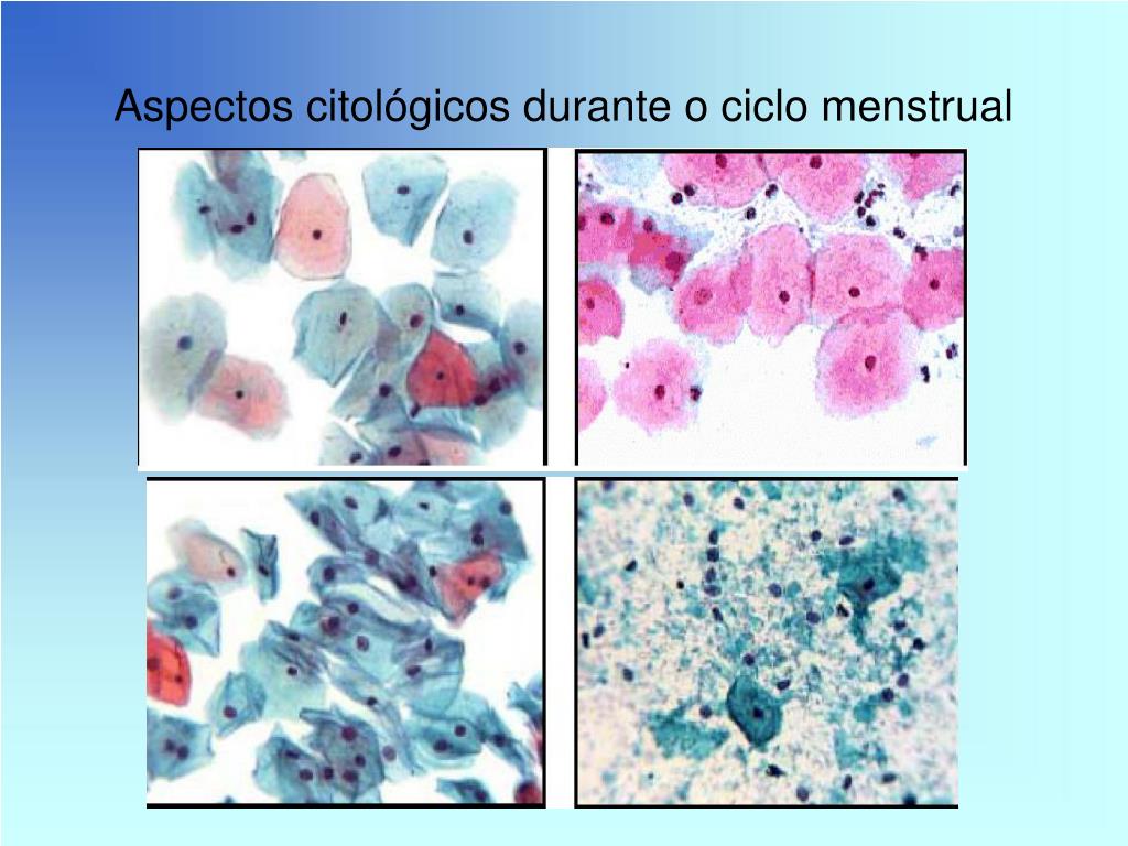 Ppt Colheita ColoraÇÃo E Citologia CÉrvico Vaginal Normal Powerpoint Presentation Id3821530 2001