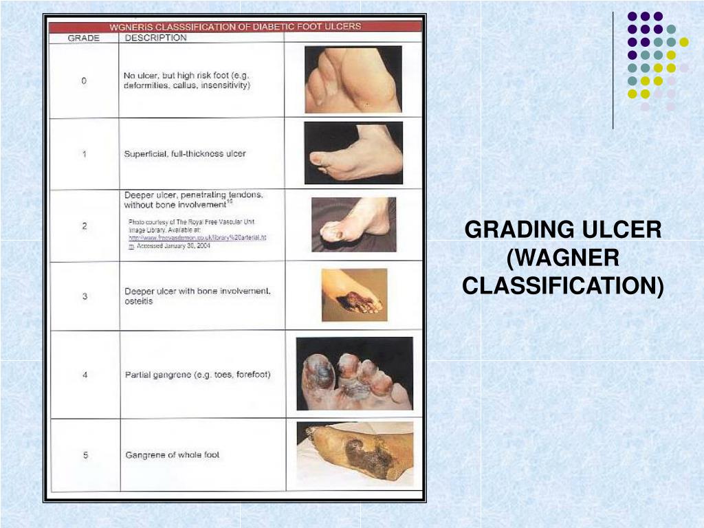 PPT - DIABETIC FOOT CARE PowerPoint Presentation, free download - ID