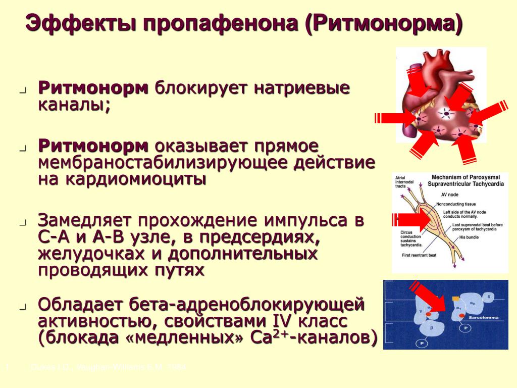 Ритмонорм Инструкция По Применению Цена Отзывы Кардиологов