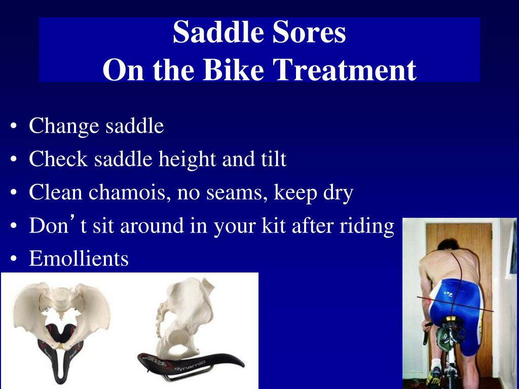 PPT Cycling Injuries PowerPoint Presentation, free download ID3830594