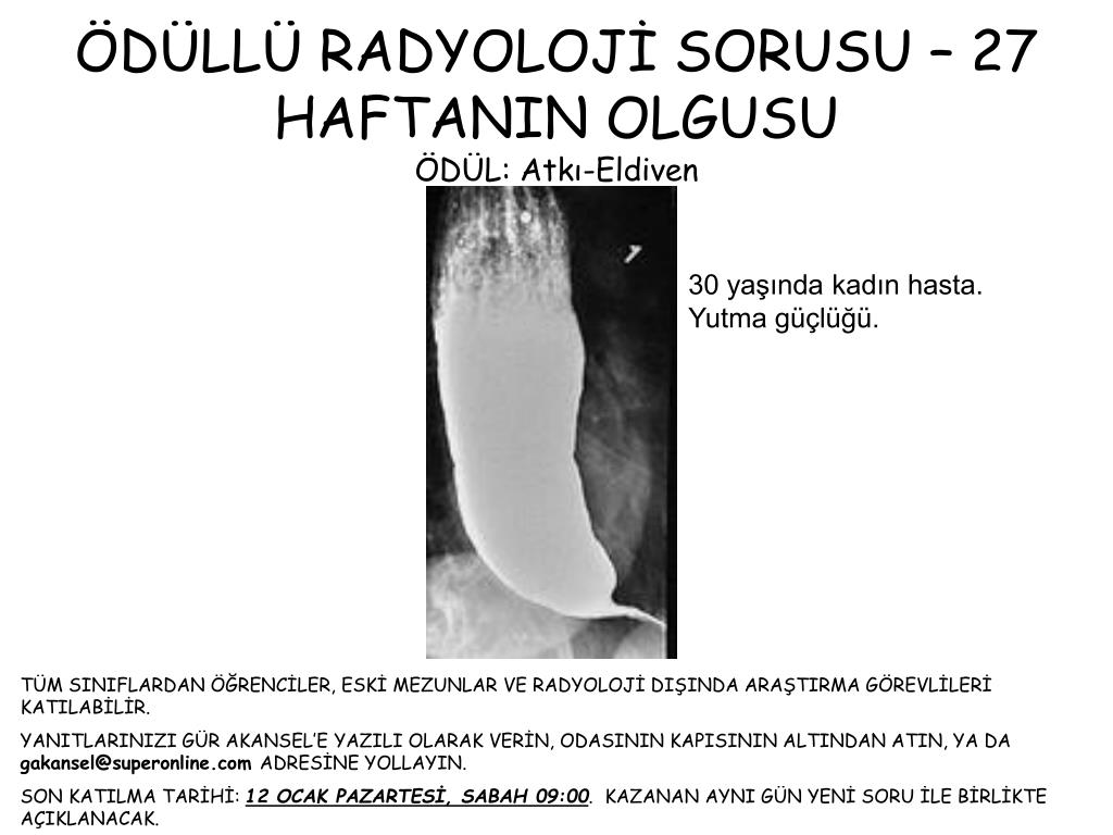 Öğrenciler ne için dilate edildi Öğrenciler ne için dilate edildi