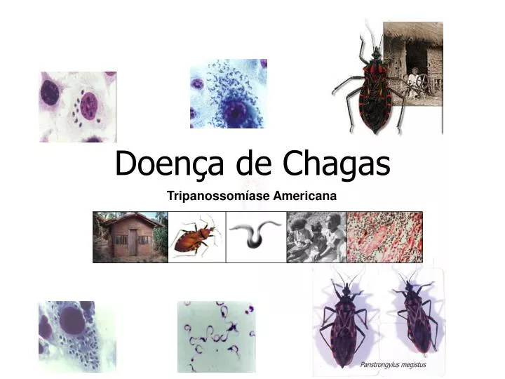 Com Relação A Doença De Chagas Indique