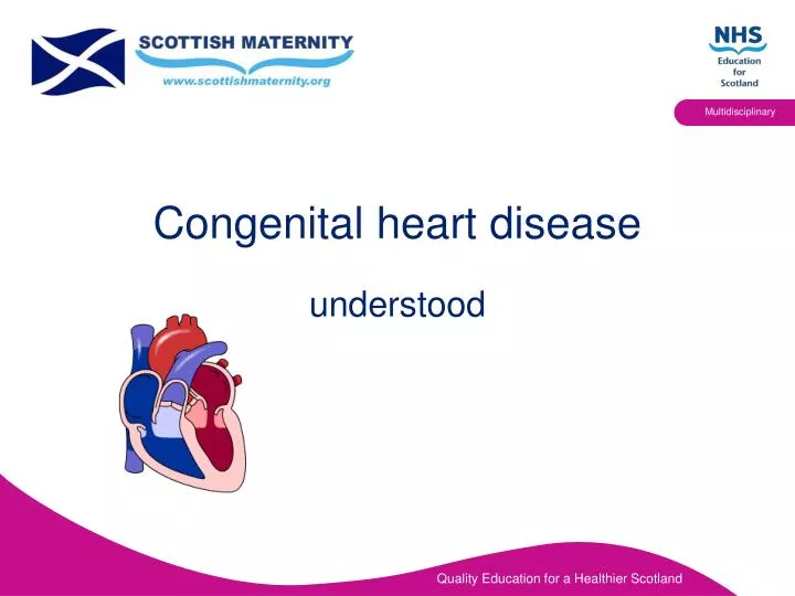 powerpoint presentation on congenital heart disease