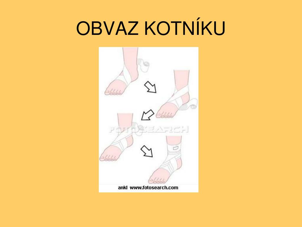 PPT - ZDRAVOVĚDA - 9. ročník OBVAZOVÁ TECHNIKA PowerPoint Presentation -  ID:3839966