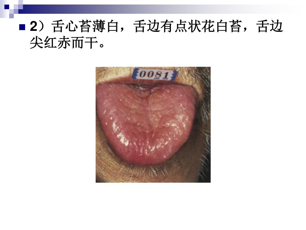我会看舌苔，哪位患儿家长要学吗？_澎湃号·湃客_澎湃新闻-The Paper