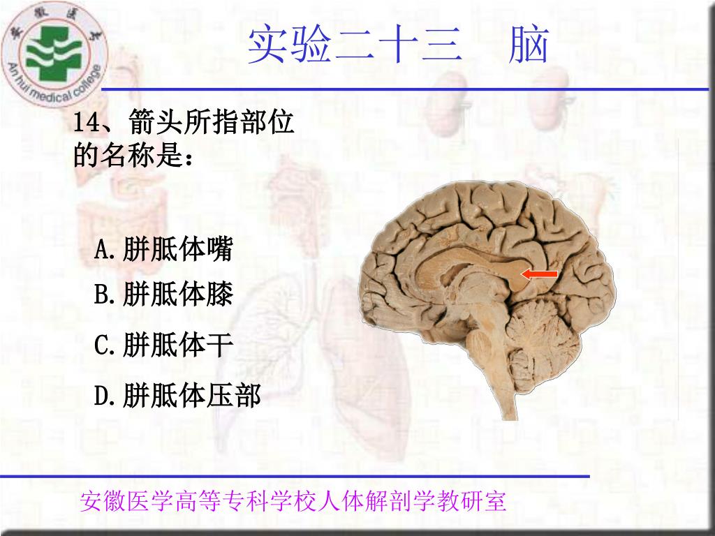 Ppt 实验二十三脑powerpoint Presentation Free Download Id Ppt 实验二十三脑powerpoint Presentation Free Download Id
