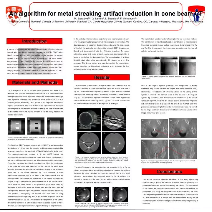 PPT - An algorithm for metal streaking artifact reduction in cone beam ...