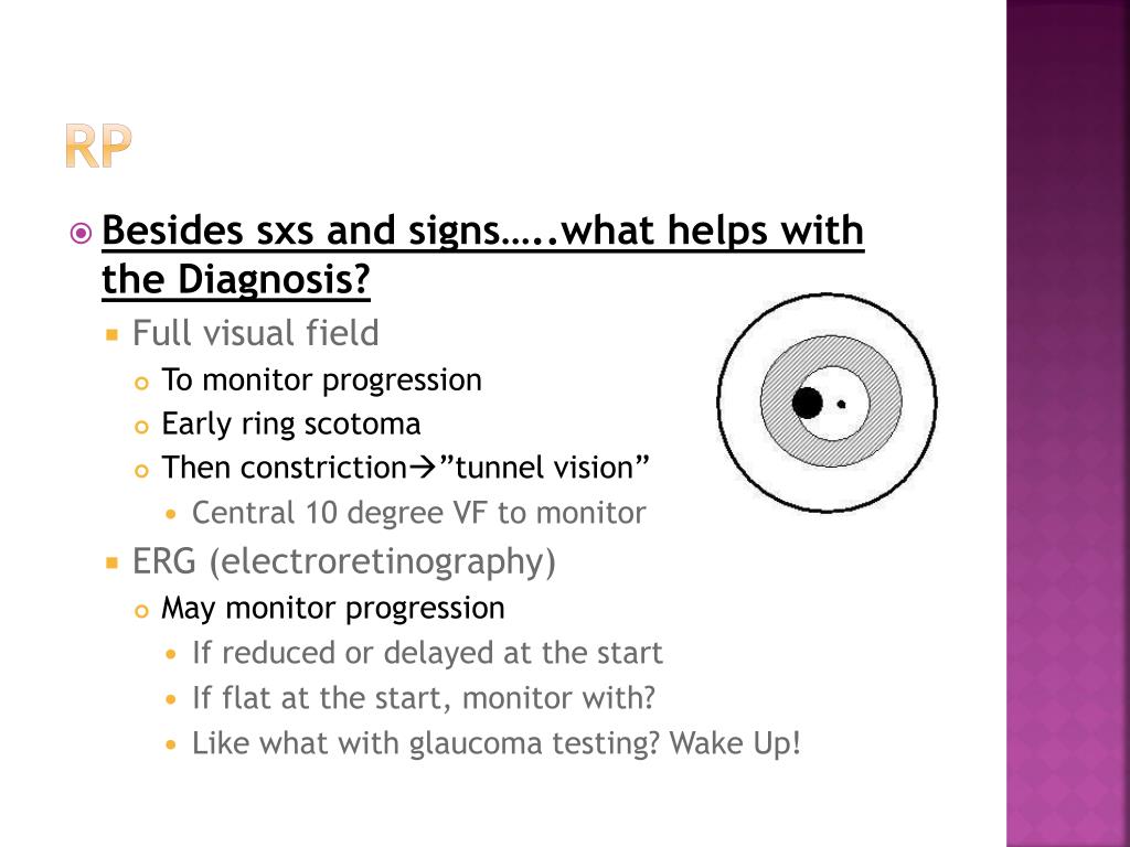 Differential Diagnosis: Hallows Around Light | PDF | Retina | Cornea