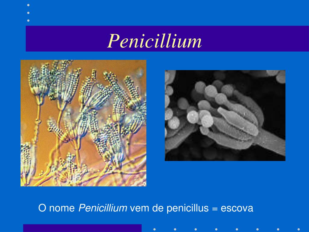 Пеницилл и бактерии. Плесневые грибы рода Penicillium. Грибов рода Penicillium. Плесень пенициллиум. Микроскопические грибы пеницилл.