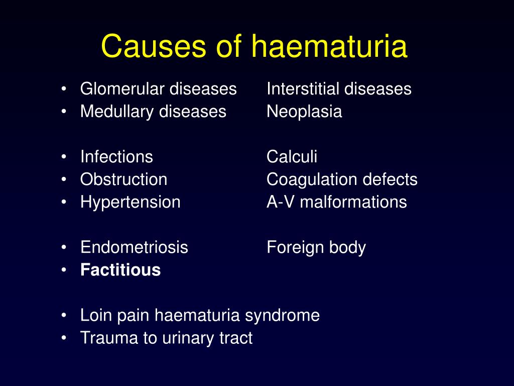 Loin pain haematuria syndrome –