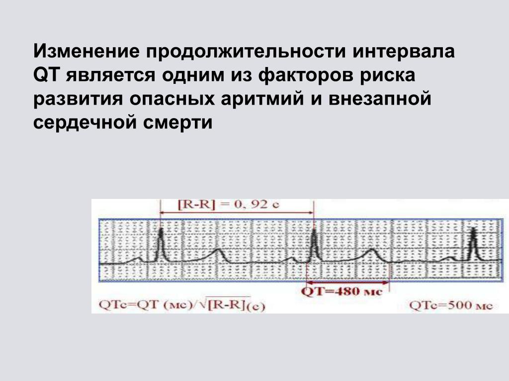 Интервал qt холтер. Интервалы PQ И qt в ЭКГ. Синдром удлиненного интервала qt на ЭКГ. Нормальный интервал qt на ЭКГ норма. Qt QTC на ЭКГ норма.