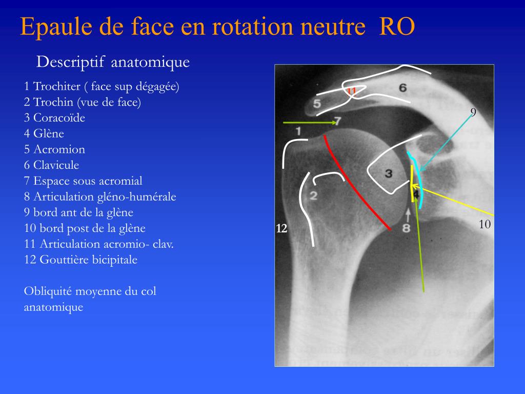 Schema D une Articulation De L epaule En Coupe Plan Frontal PPT - ANATOMIE RADIOLOGIQUE DE L'EPAULE PowerPoint Presentation, free download - ID:3887749