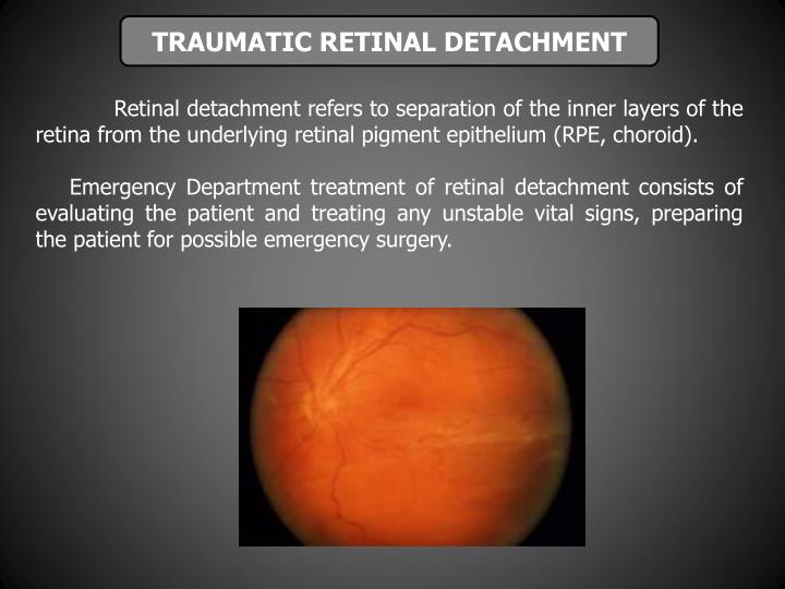 PPT - OCULAR TRAUMA. DIAGNOSIS AND TREATMENT. PowerPoint Presentation ...