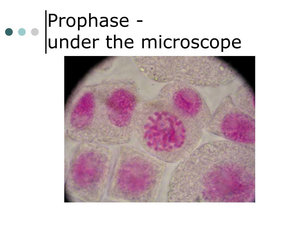 prophase microscope