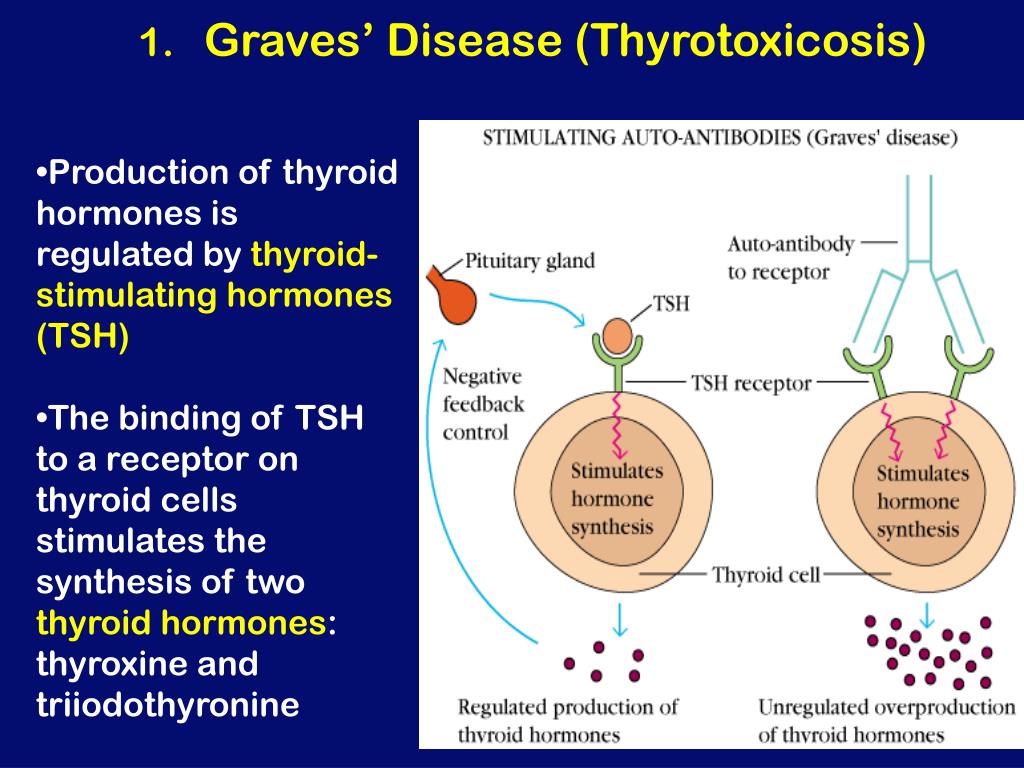 Диффузный токсический зоб гормоны. Etiology thyrotoxicosis. Thyroid Hormone Synthesis.