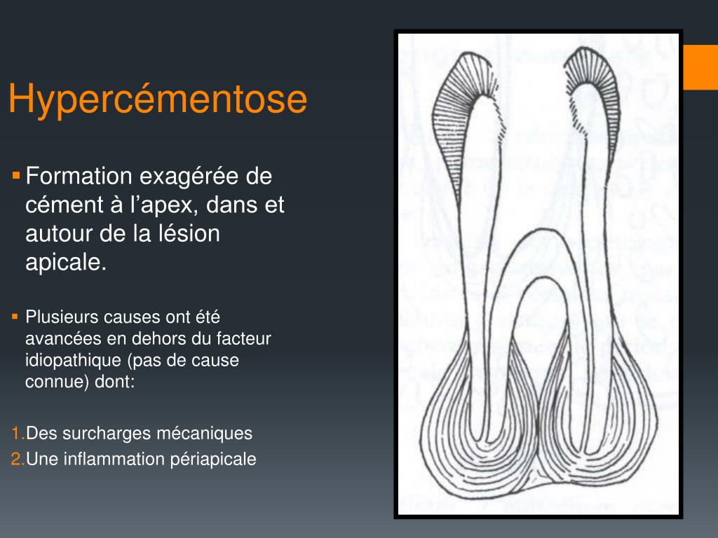 PPT Les Maladies Apicales Ou P riapicales PowerPoint Presentation PPT Les Maladies Apicales Ou P riapicales PowerPoint Presentation