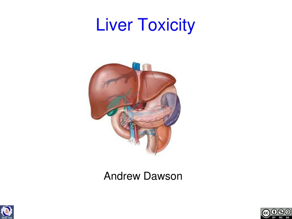PPT Liver Toxicity PowerPoint Presentation, free download ID3938556