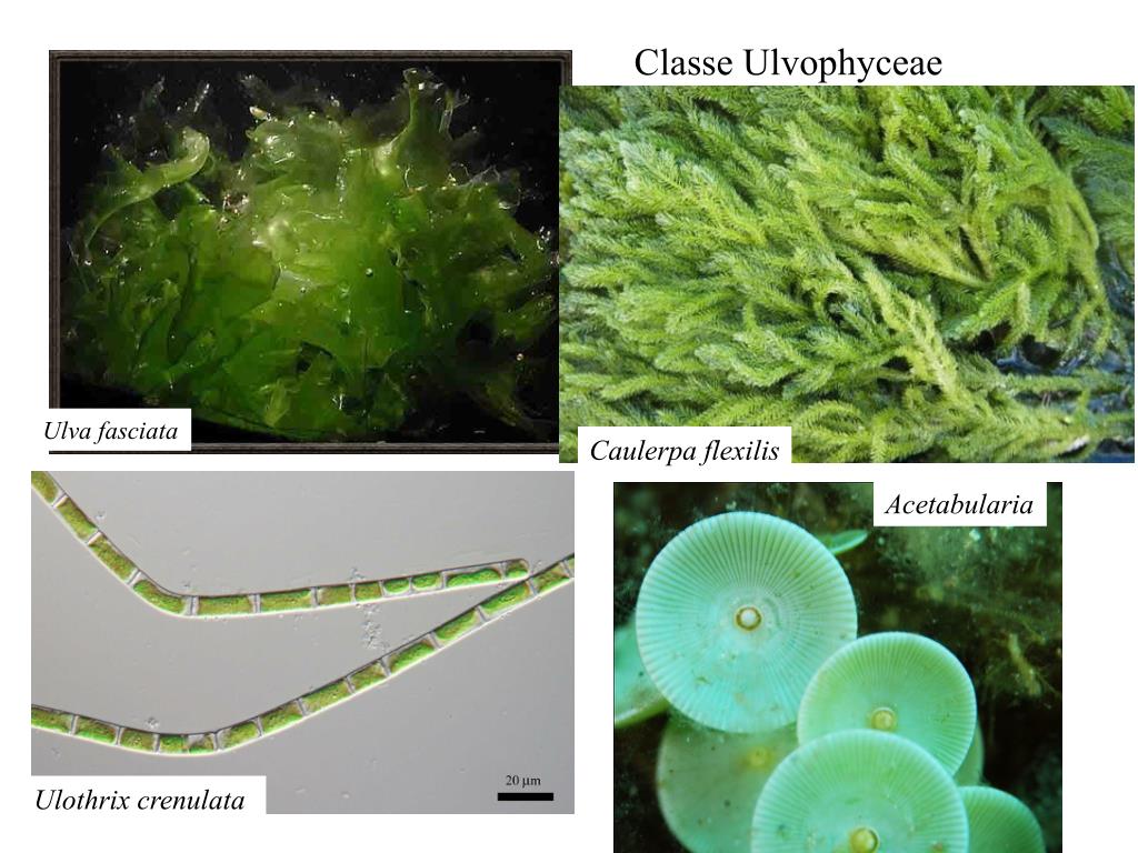 Улотрикс Ульва. Ульва под микроскопом. Улотрикс фото. Многоклеточные зеленые водоросли улотрикс.