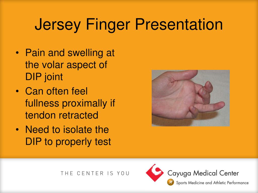 PPT - Common Hand and Wrist Injuries PowerPoint Presentation, free download  - ID:3950482