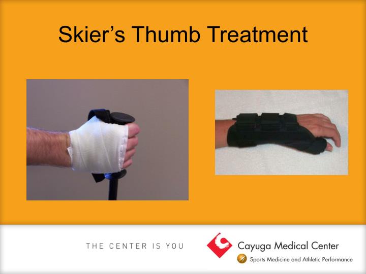 PPT Common Hand and Wrist Injuries PowerPoint Presentation ID3950482