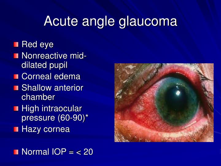 PPT Ophthalmologic Emergencies PowerPoint Presentation ID3951268