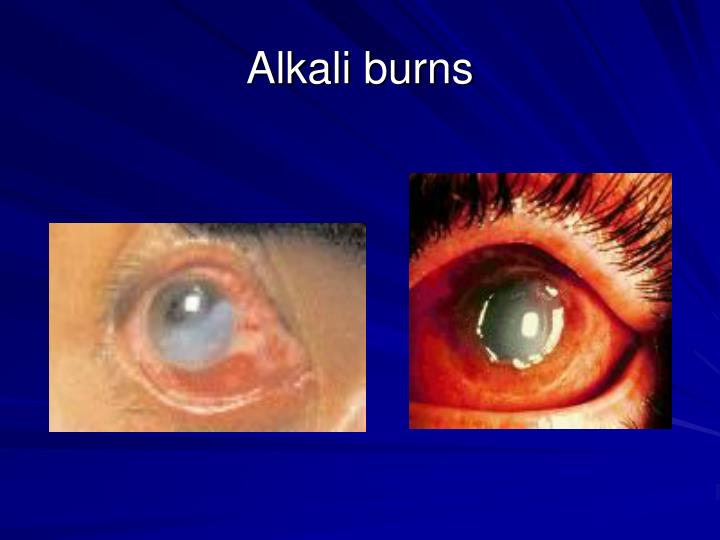 PPT Ophthalmologic Emergencies PowerPoint Presentation ID3951268