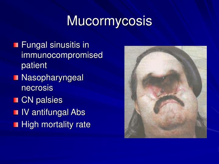 PPT - Ophthalmologic Emergencies PowerPoint Presentation - ID:3951268