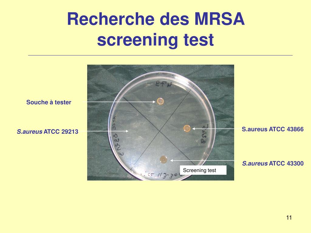 Screening test. Диагностический тест на выявление MRSA. Staphylococcus aureus (ATCC 29213). Эллипс тест.