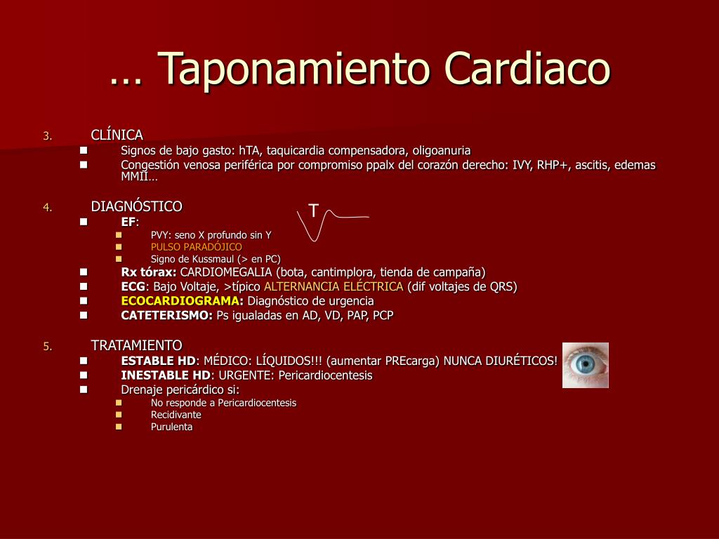 Signo de Kussmaul Fisiopatología de la hipertensión