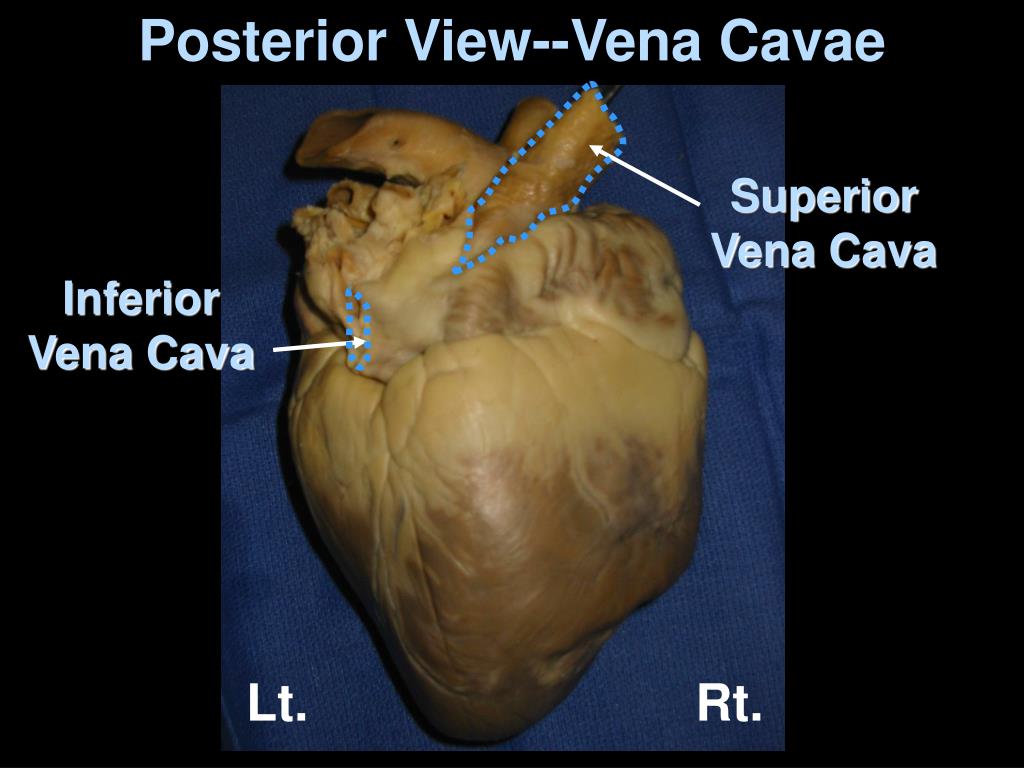 PPT - Pig Heart Dissection 101 PowerPoint Presentation, free download
