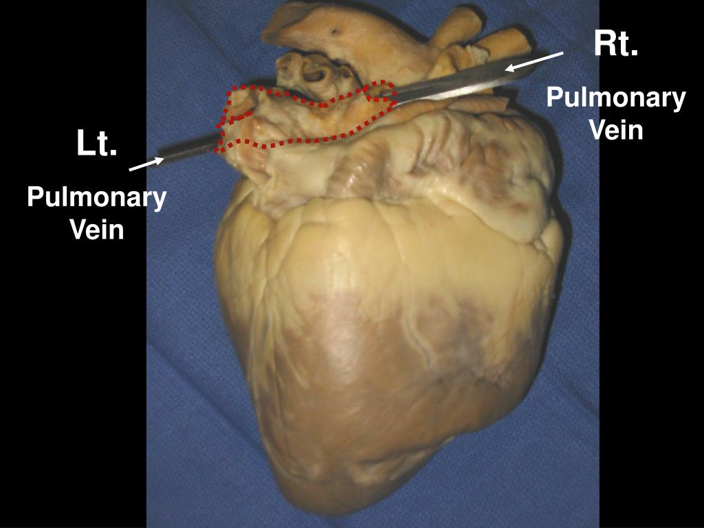 PPT - Pig Heart Dissection 101 PowerPoint Presentation, free download