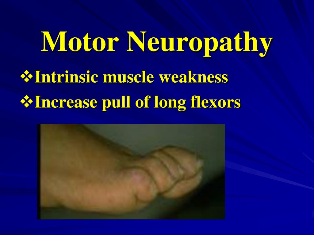 PPT Wound Care and Diabetic Neuropathic Ulcer Cordell â€œCorkyâ€ Atkins PT, DPT, CWS, CDE